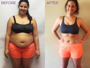HCG Injections for Weight Loss Before and After